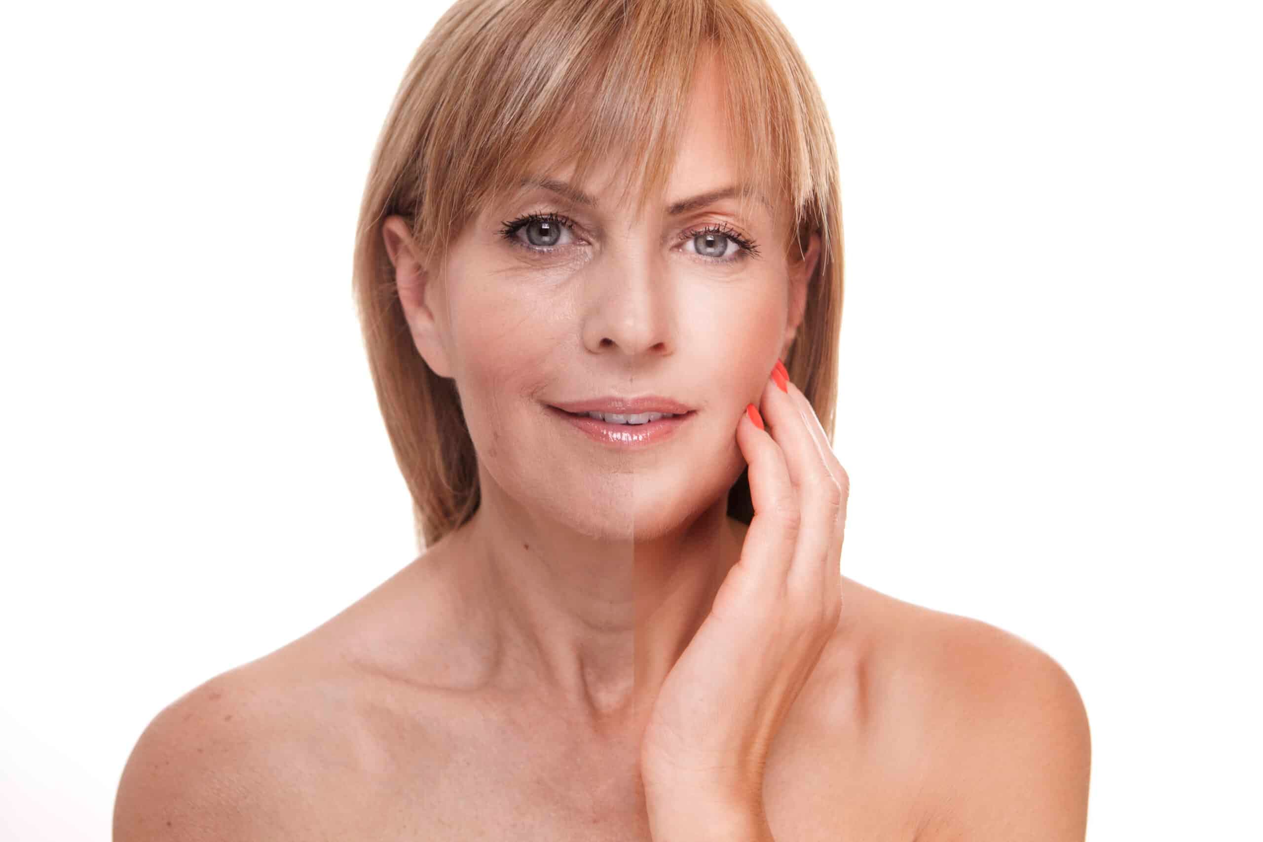 HBOT for blood flow circulation and ageing skin