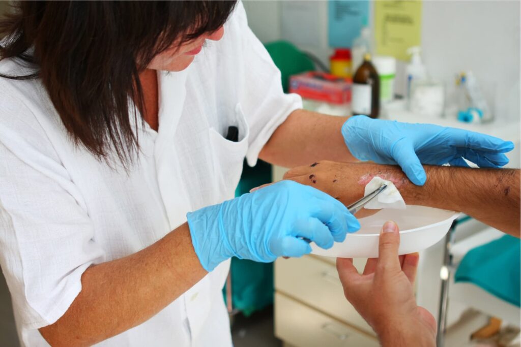 image of nurse treating a wound for post on Hyperbaric Oxygen Therapy for Wound Healing